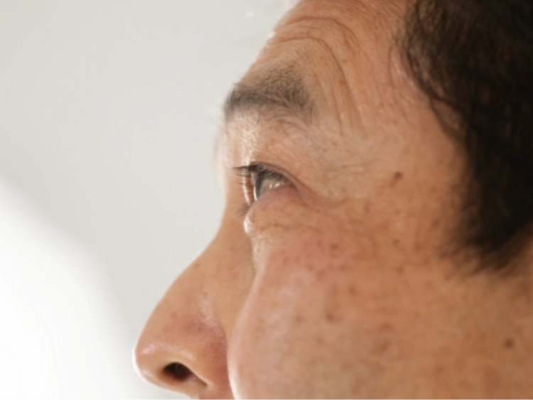 白内障