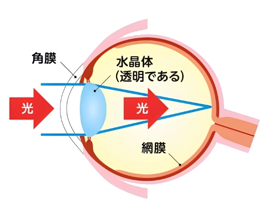 正常な目
